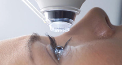 femto lasik phẫu thuật không dùng dao