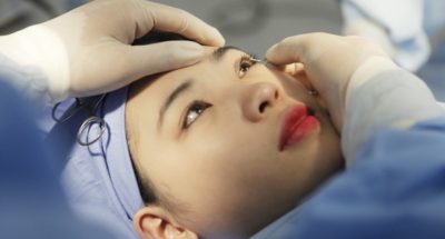 có nên phẫu thuật một mắt trước hay không