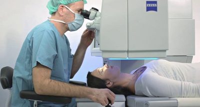 Phương pháp mổ cận thị Femto Lasik