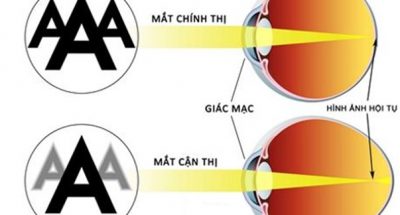 tat-khuc-xa-la-gi