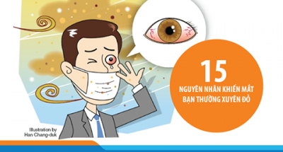 15-nguyen-nhan-khien-mat-ban-thuong-xuyen-bi-do