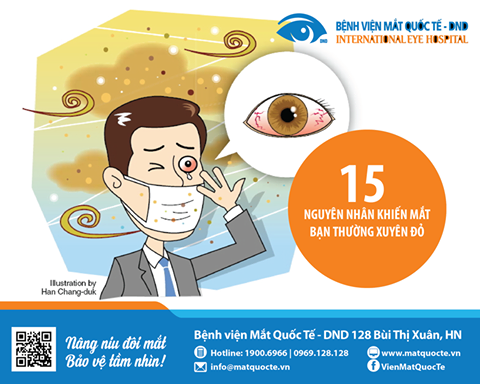 15-nguyen-nhan-khien-mat-ban-thuong-xuyen-bi-do