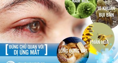 dị ứng mắt