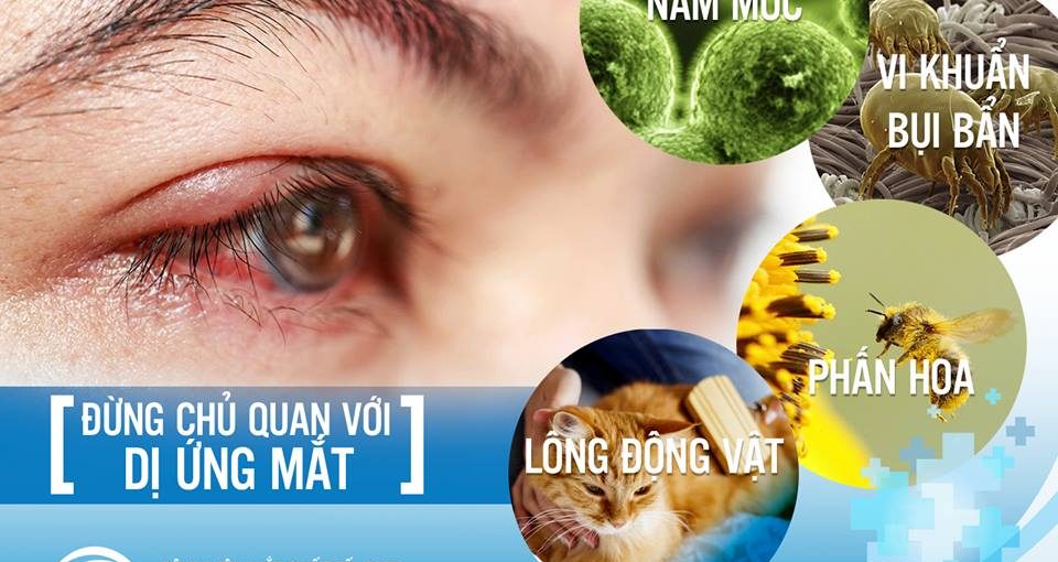 dị ứng mắt